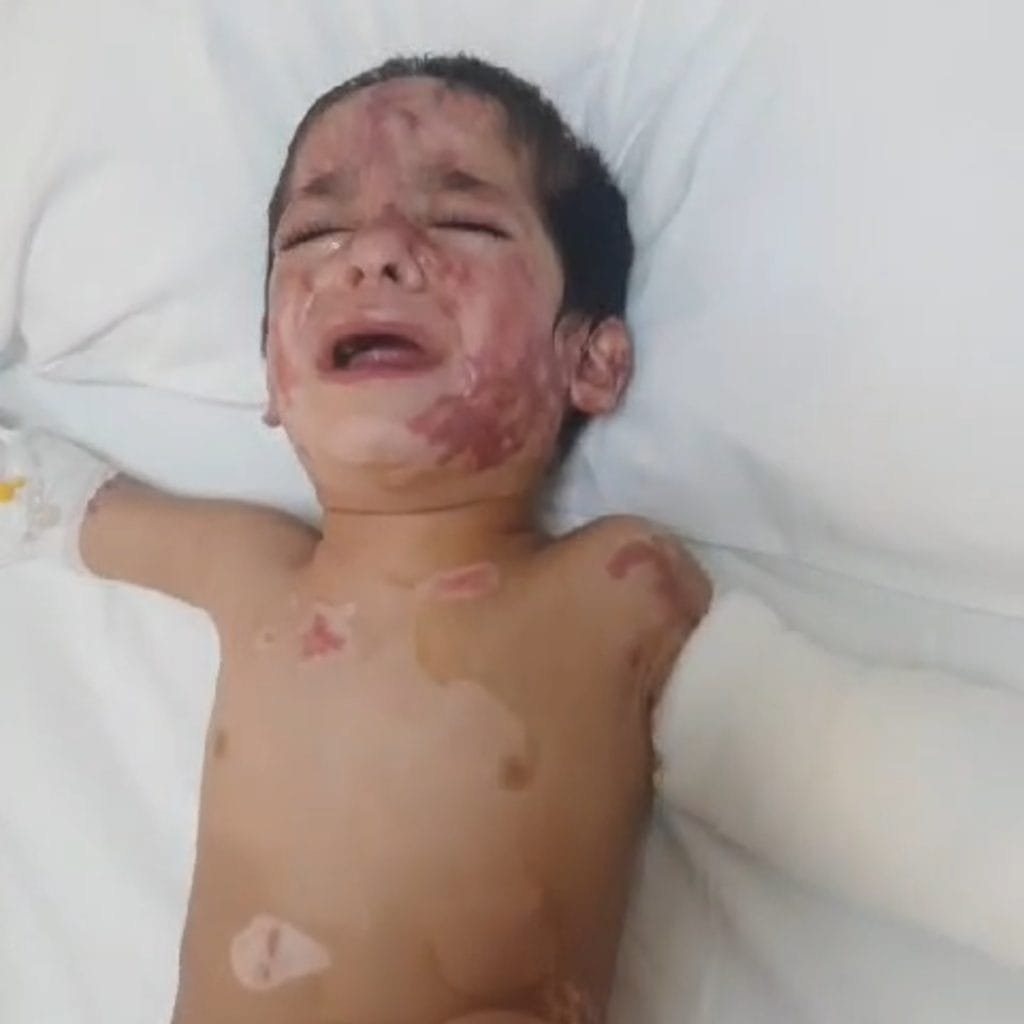 Depremzede aile bir çocuğunu yangında kaybetti diğer çocuğunun tedavisi için yardım elinin uzanmasını bekliyor