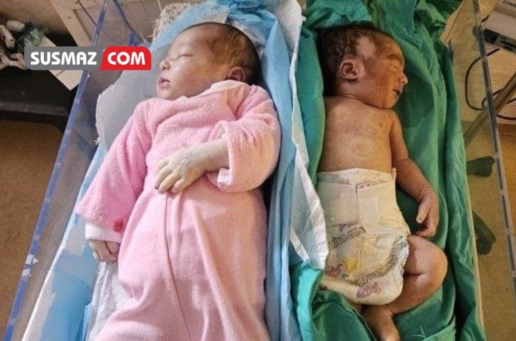 Gazze’de Açlıktan Ölen Bebeklerin Sayısı 15’e Ulaştı: İnsanlık Krizi Derinleşiyor