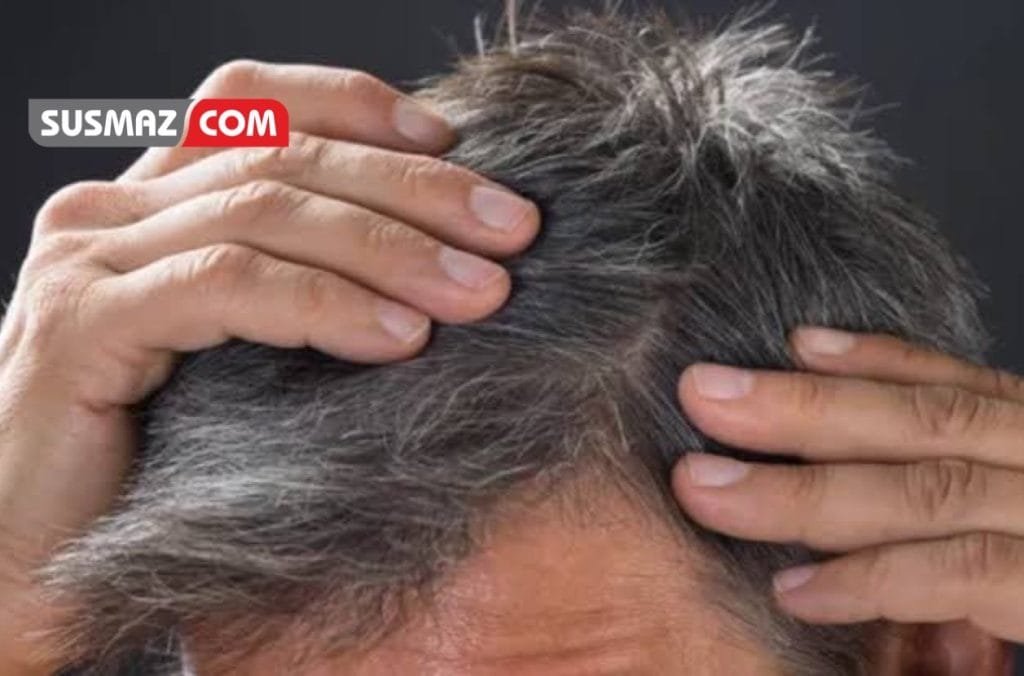 “Saç Beyazlamasına Neden Olan Faktörler ve Önlemler”