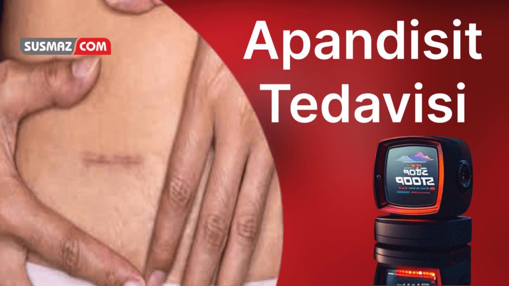 “Apandisit Ameliyatı: Ne Zaman Gerekir ve Süreç Nasıl İşler?”