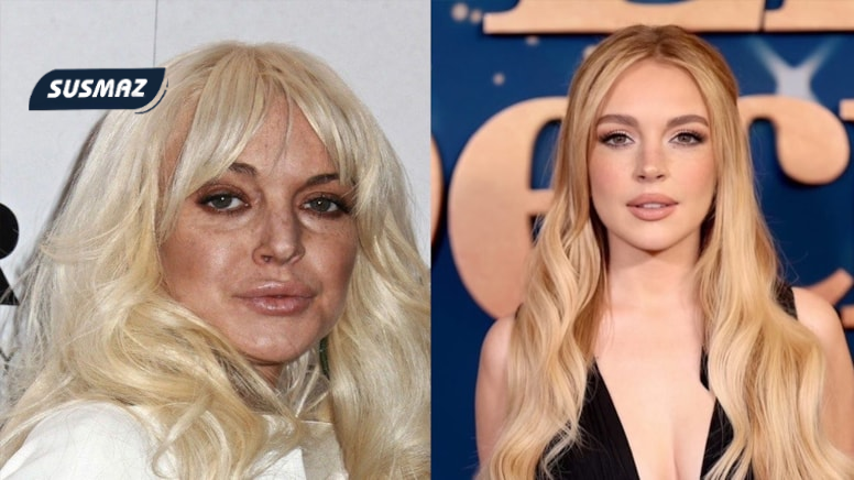 12 Milyon TL’lik Estetikle Yenilenen Ünlü: Her Kuruşuna Değdi!